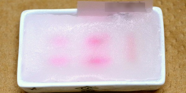 パラフィン切片