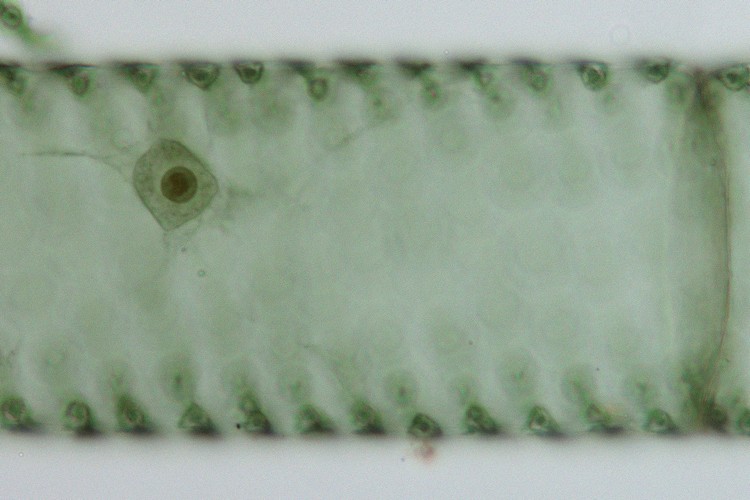 アオミドロの1種