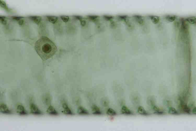 アオミドロの1種