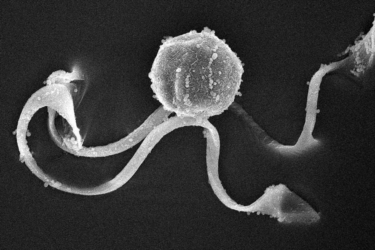 スギナ(ツクシ)