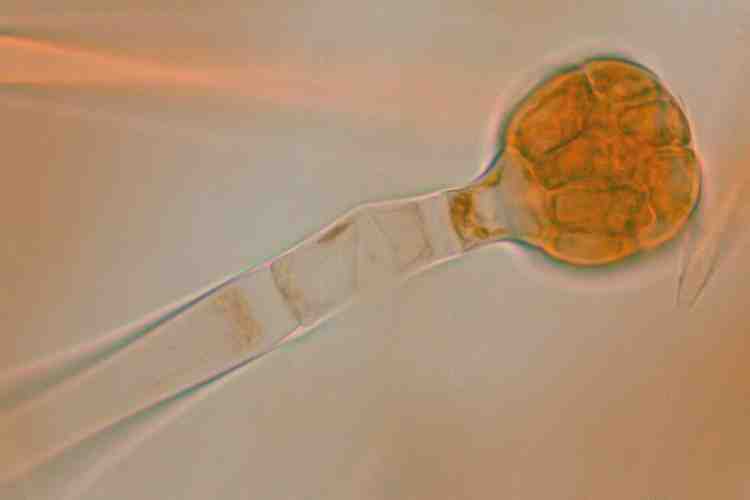 スイカズラ属の1種